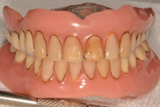 Before